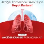 WhatsApp-Image-2025-10-31-at-13.11.51-150x150 AKCİĞER KANSERİ FARKINDALIK AYI